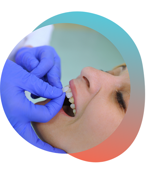 Woman receiving veneers on front teeth