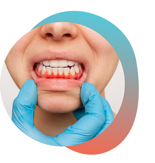 Pulling down lips to show inflamed gums